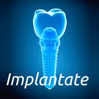Implantate / Implantologie